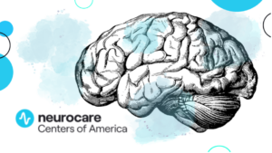 neurocare centers of america