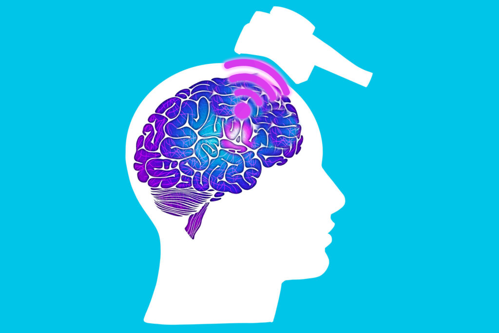 TMS vs Antidepressants